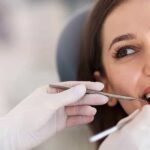 Veneers 101